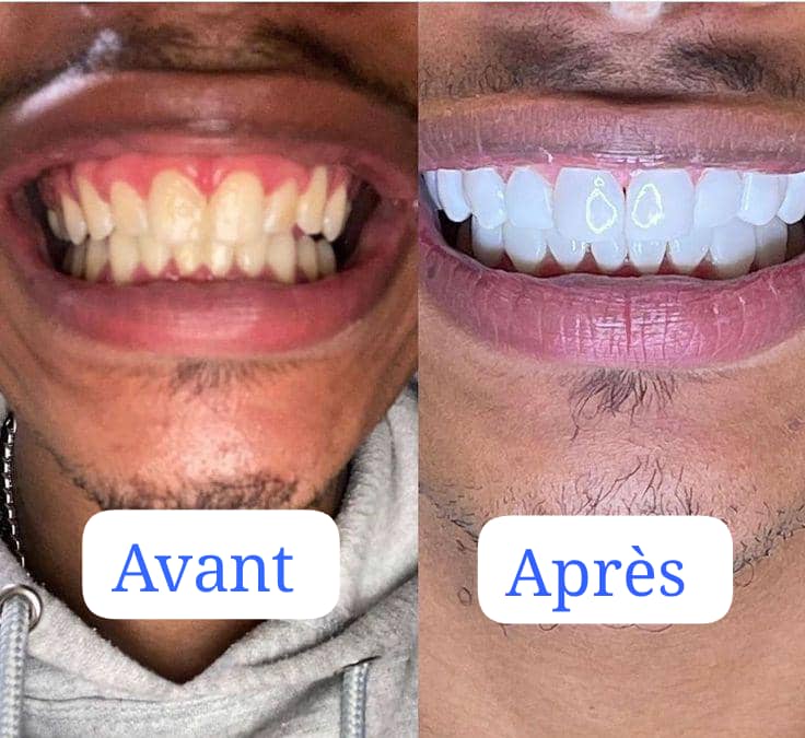 Dentifrice bodyAccel