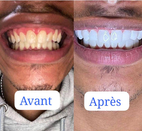 Dentifrice bodyAccel